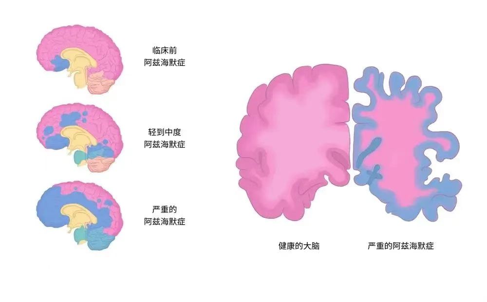 说明: aee4b3f8b1962064869417abe37c930
